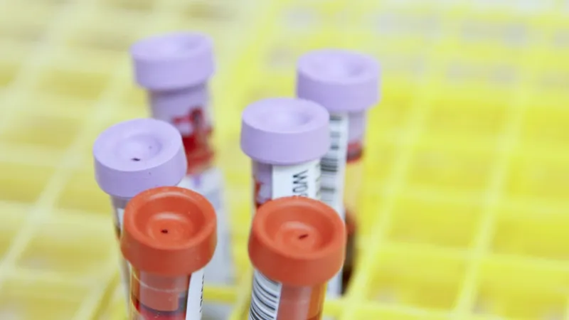 Blodprovsrör i ett provställ på ett laboratorium, av den typ som används vid analys av kobalamin